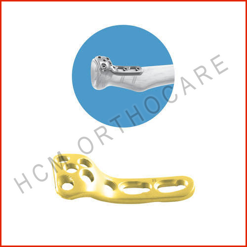 2.7mm-redial-head-rim-locking-plate - HCM Ortho 2.7mm-redial-head-rim-locking-plate