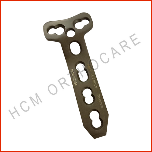 5.0-mm-buttress-locking-plate-1 - HCM Ortho 5.0-mm-buttress-locking-plate-