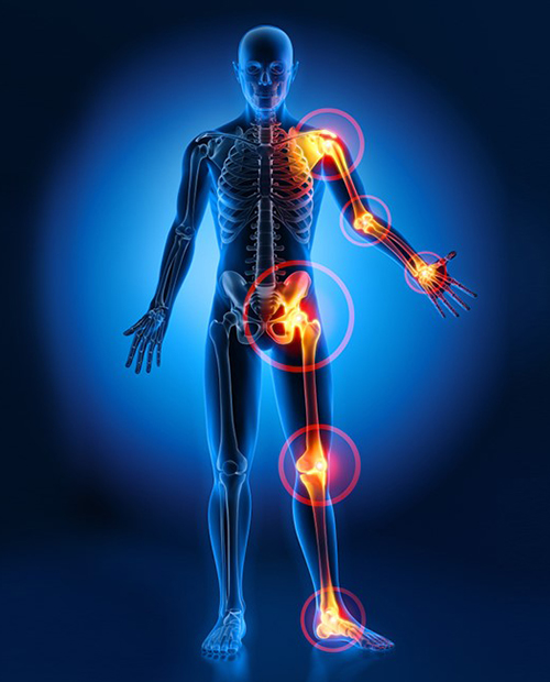 About - HCM Ortho full body pain image