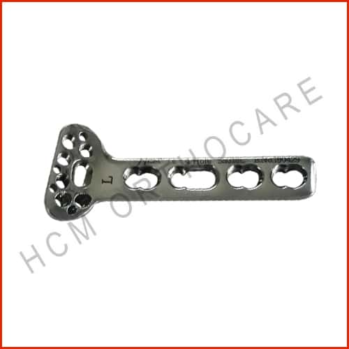 2.7mm-3.5mm-distal-redius-volar-column-locking-plate - HCM Ortho 2.7mm-3.5mm-distal-redius-volar-column-locking-plate