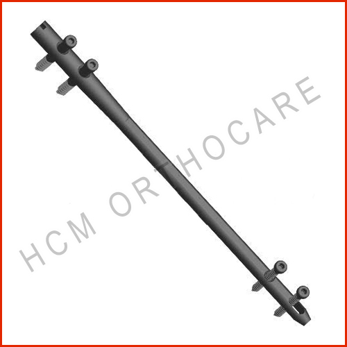 supracondyler-nail - HCM Ortho supracondyler-nail